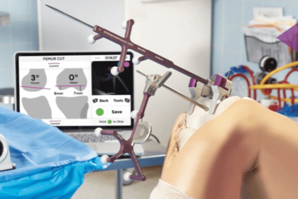 Total Hip replacement