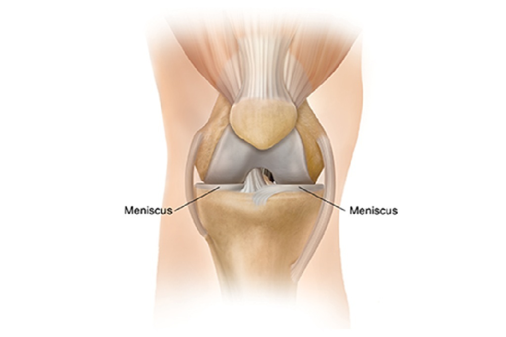 Arthroscopic meniscus repair and salvage surgery